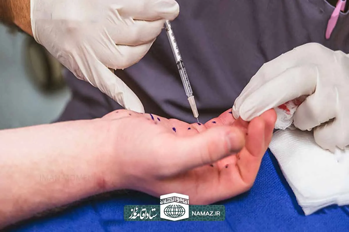 احکام بوتاکس و وضو - نحوه وضو گرفتن بعد از بوتاکس